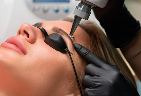 Remove micropigmentation in Barcelona